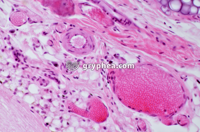 Petits vaisseaux sanguins dans la trachée de Rat x100 - gryphea.com